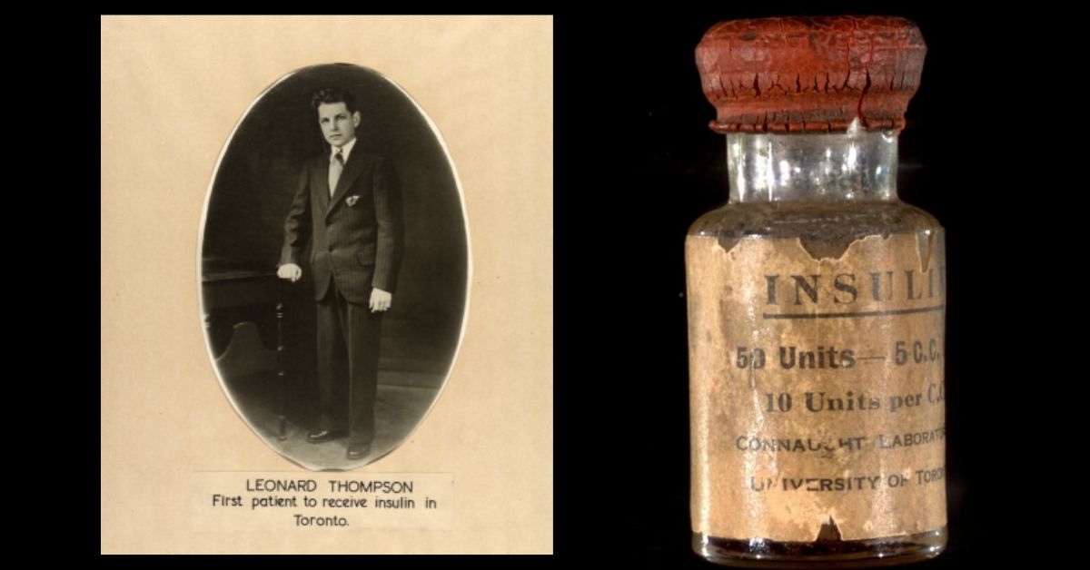 La scoperta dell'insulina. Leonard Thompson, il primo paziente trattato con insulina